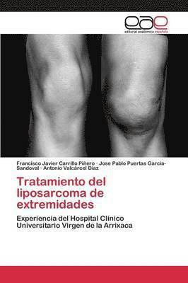 bokomslag Tratamiento del liposarcoma de extremidades