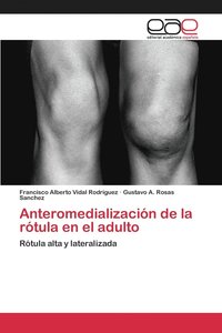 bokomslag Anteromedializacin de la rtula en el adulto