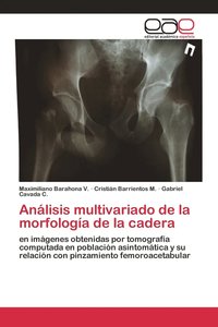 bokomslag Anlisis multivariado de la morfologa de la cadera