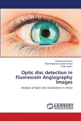 bokomslag Optic disc detection in Fluorescein Angiography Images