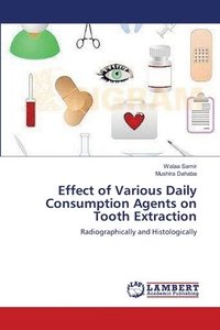 bokomslag Effect of Various Daily Consumption Agents on Tooth Extraction