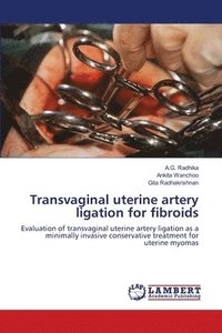 bokomslag Transvaginal uterine artery ligation for fibroids