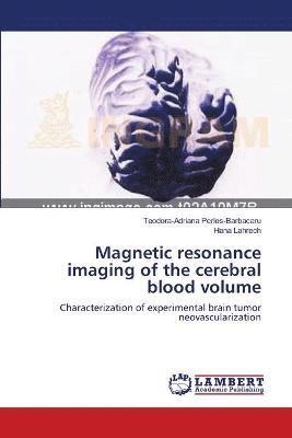 Magnetic resonance imaging of the cerebral blood volume 1