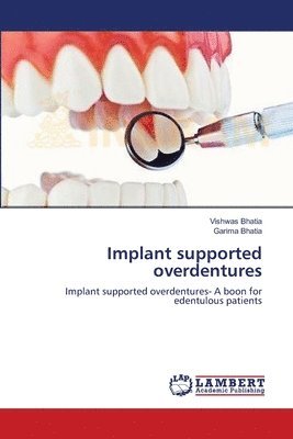 bokomslag Implant supported overdentures