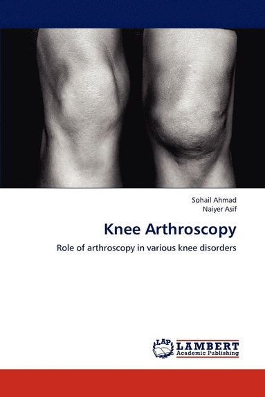 bokomslag Knee Arthroscopy