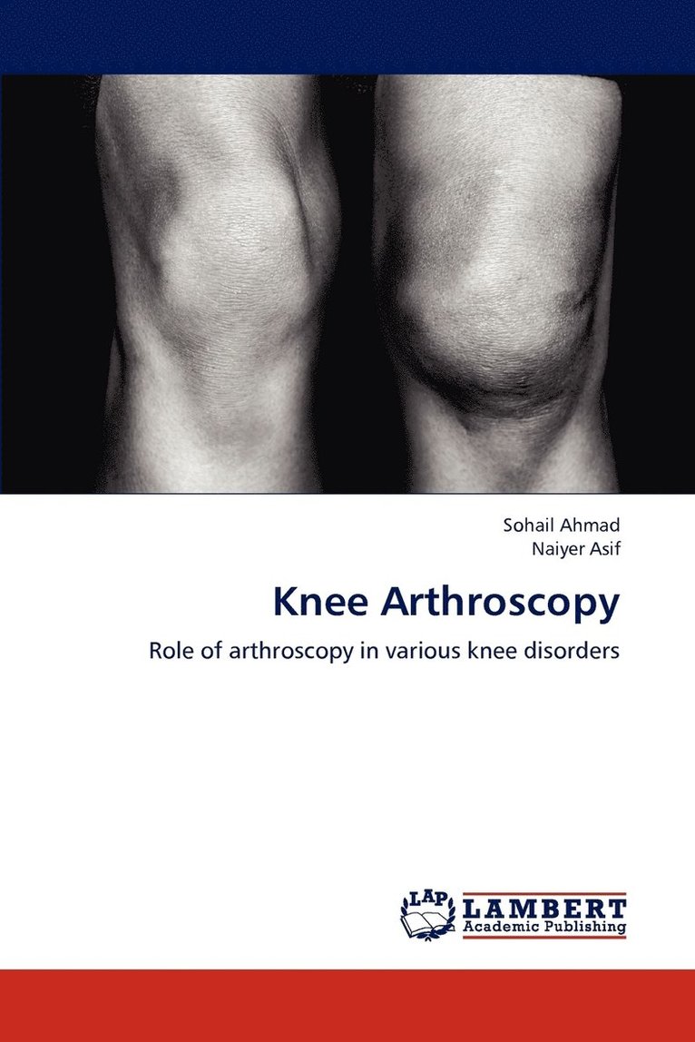 Knee Arthroscopy 1