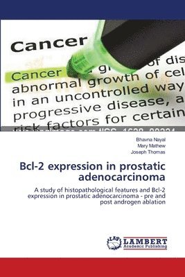 bokomslag Bcl-2 expression in prostatic adenocarcinoma