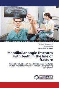 bokomslag Mandibular angle fractures with teeth in the line of fracture