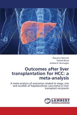 Outcomes after liver transplantation for HCC 1