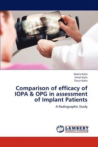 bokomslag Comparison of efficacy of IOPA & OPG in assessment of Implant Patients