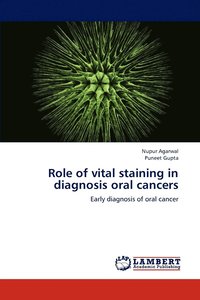 bokomslag Role of vital staining in diagnosis oral cancers