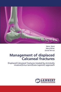 bokomslag Management of displaced Calcaneal fractures