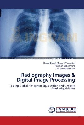 Radiography Images & Digital Image Processing 1
