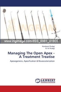 bokomslag Managing The Open Apex - A Treatment Treatise