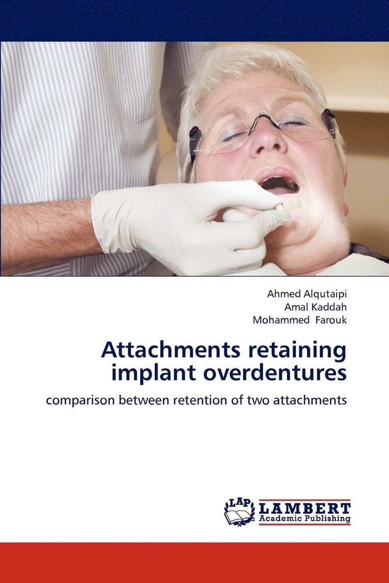 Attachments retaining implant overdentures 1