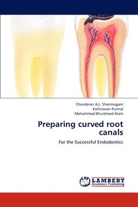 bokomslag Preparing curved root canals
