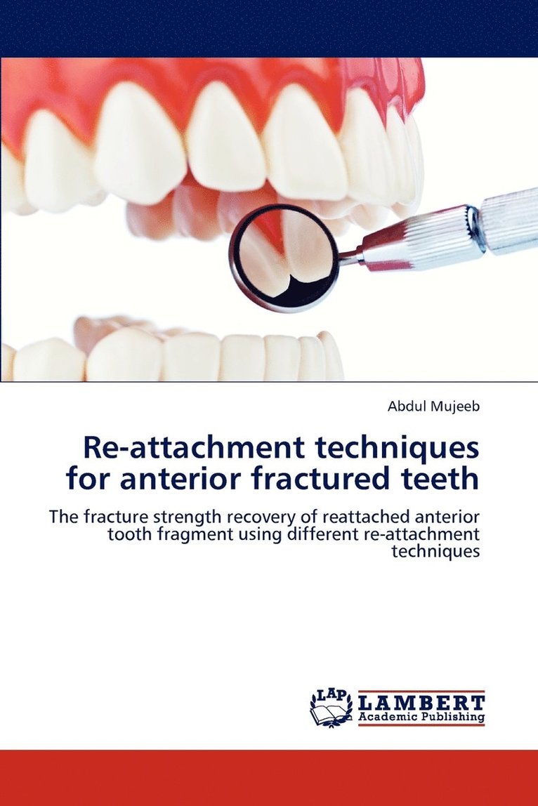 Re-attachment techniques for anterior fractured teeth 1