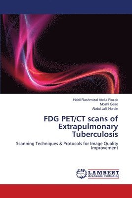 bokomslag FDG PET/CT scans of Extrapulmonary Tuberculosis