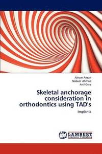 bokomslag Skeletal anchorage consideration in orthodontics using TAD's