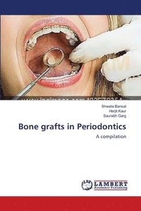 bokomslag Bone grafts in Periodontics