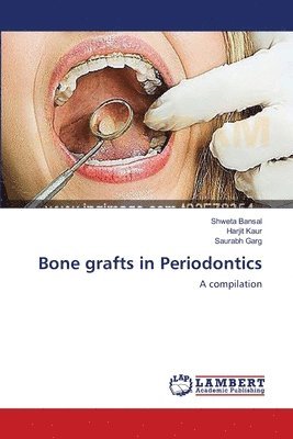 Bone grafts in Periodontics 1