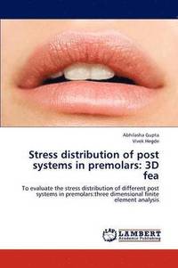 bokomslag Stress distribution of post systems in premolars