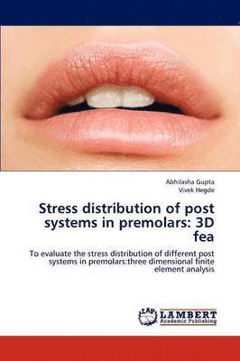 Stress distribution of post systems in premolars 1