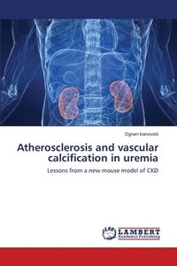 bokomslag Atherosclerosis and vascular calcification in uremia