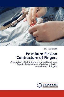 Post Burn Flexion Contracture of Fingers 1