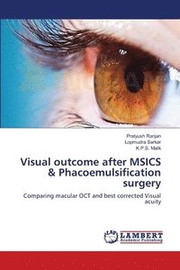 bokomslag Visual outcome after MSICS & Phacoemulsification surgery
