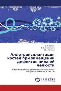 bokomslag Allotransplantatsiya Kostey Pri Zameshchenii Defektov Nizhney Chelyusti