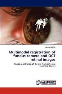 bokomslag Multimodal registration of fundus camera and OCT retinal images