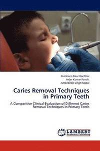 bokomslag Caries Removal Techniques in Primary Teeth