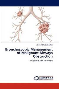 bokomslag Bronchoscopic Management of Malignant Airways Obstruction