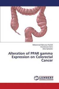 bokomslag Alteration of PPAR gamma Expression on Colorectal Cancer