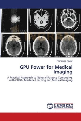 GPU Power for Medical Imaging 1
