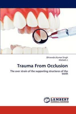 Trauma from Occlusion 1