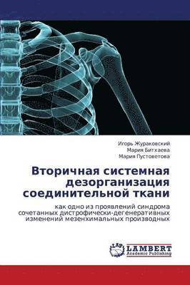 bokomslag Vtorichnaya Sistemnaya Dezorganizatsiya Soedinitel'noy Tkani