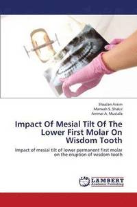 bokomslag Impact of Mesial Tilt of the Lower First Molar on Wisdom Tooth