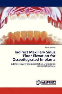 bokomslag Indirect Maxillary Sinus Floor Elevation for Osseoitegrated Implants