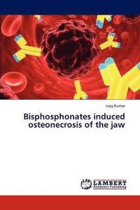 bokomslag Bisphosphonates induced osteonecrosis of the jaw