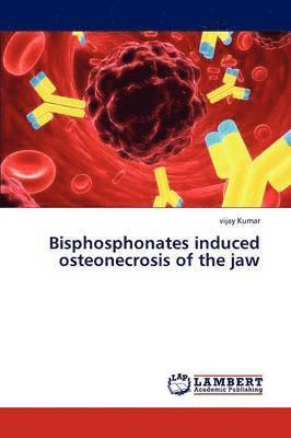 Bisphosphonates induced osteonecrosis of the jaw 1