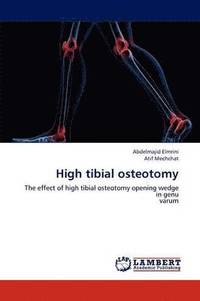bokomslag High tibial osteotomy
