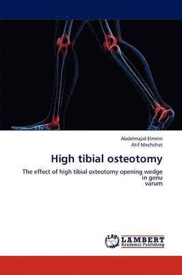High tibial osteotomy 1