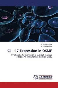 bokomslag Ck - 17 Expression in Osmf