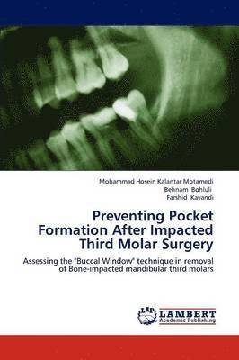 Preventing Pocket Formation After Impacted Third Molar Surgery 1