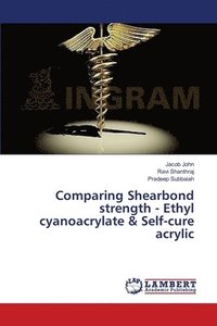 bokomslag Comparing Shearbond strength - Ethyl cyanoacrylate & Self-cure acrylic