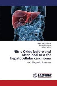 bokomslag Nitric Oxide Before and After Local Rfa for Hepatocellular Carcinoma