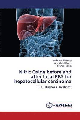 Nitric Oxide Before and After Local Rfa for Hepatocellular Carcinoma 1