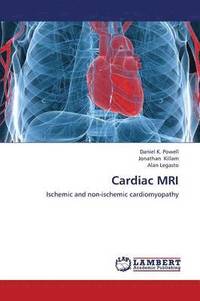 bokomslag Cardiac MRI